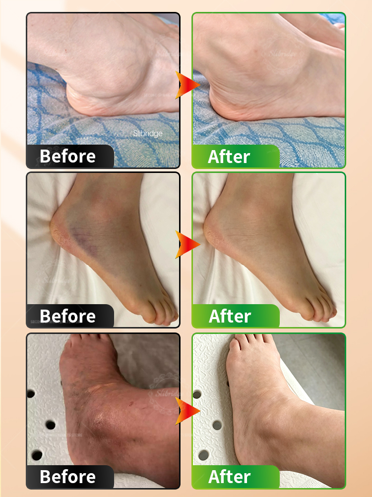 Pembalut Pemanas Pergelangan K - Ankle Mobility Band ulasan dan harga